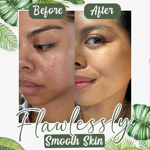 Green Mask – Blackhead Remover Cream & Deep Cleansing Face Mask